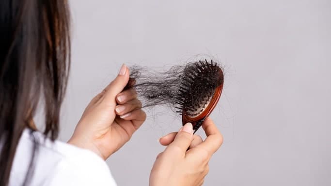 علت ریزش مو و راهکار هایی برای پیشگیری از ریزش و حفظ سلامت مو